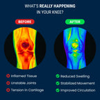 FormFit™ Knee Brace
