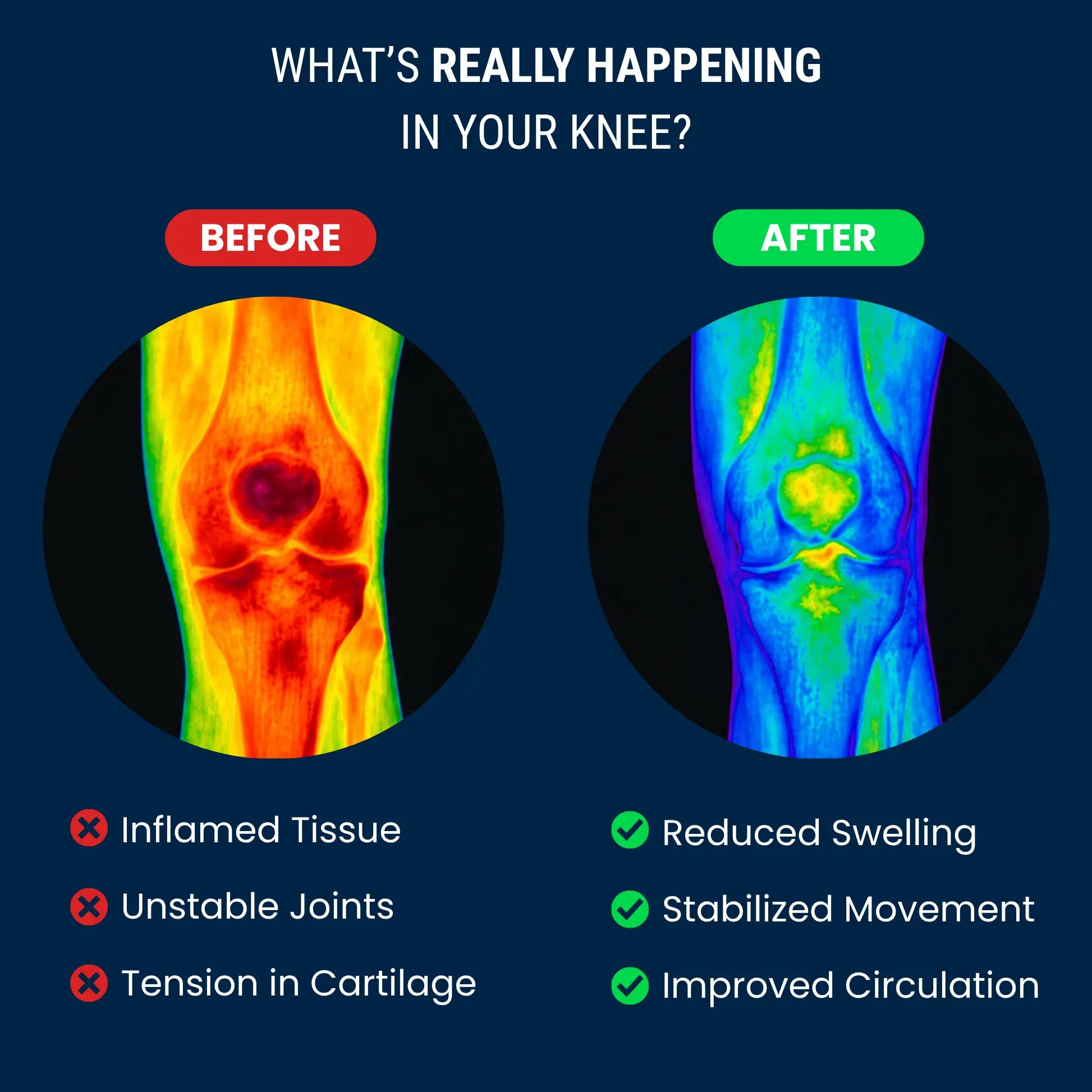 FormFit™ Knee Brace